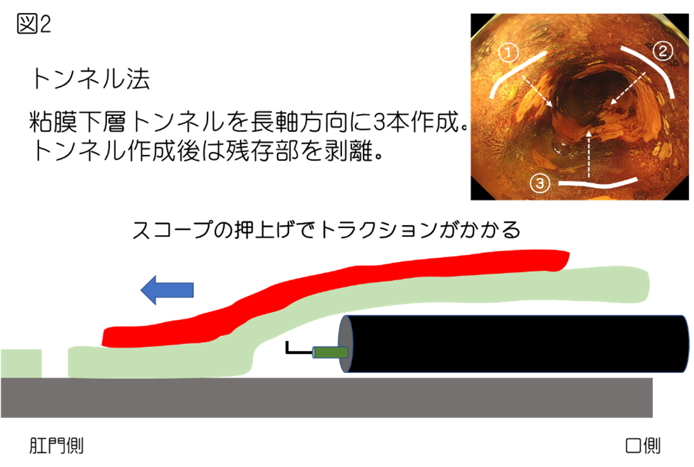 図2